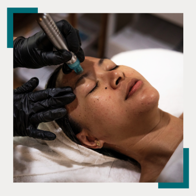 2-HYDRODERMABRASION Step two: Hydroderm Abrasion